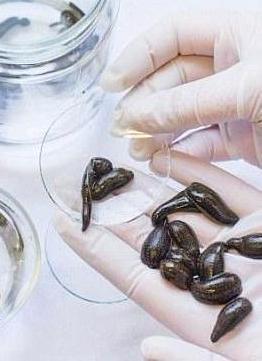 12 Leeches of Different Sizes
